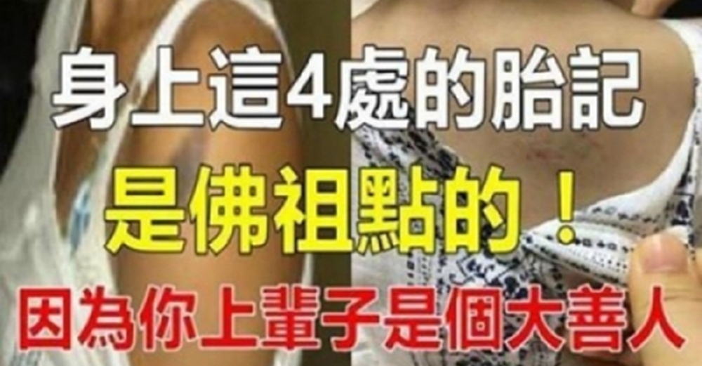 如果你身上「這四處有胎記」，恭喜了，這是因為你前世積德行善太多，佛祖留下的印記！