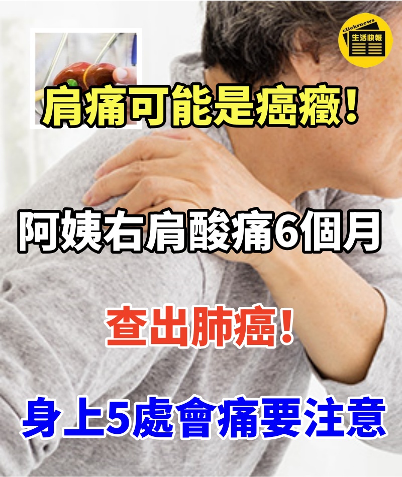 肩痛可能是癌癥!阿姨「右肩酸痛6個月」查出肺癌 「身上5處會痛」要注意了.