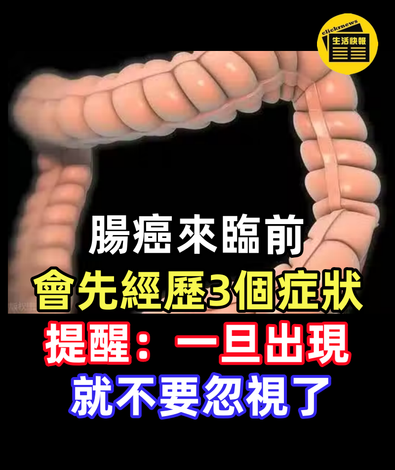 腸癌來臨前，會先經歷3個症狀，提醒：一旦出現，就不要忽視了