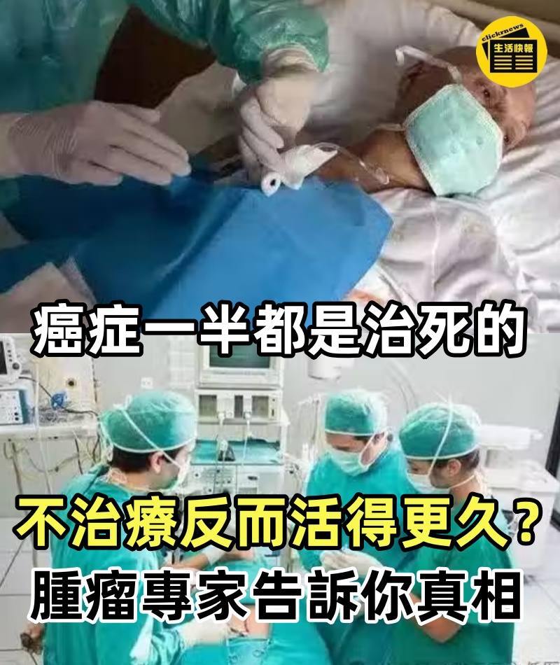 癌症一半都是治死的,不治療反而活得更久?腫瘤專家告訴你真相!