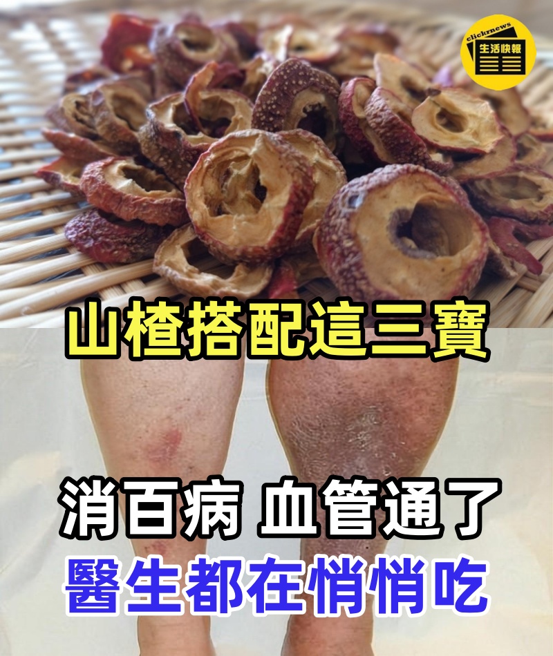 山楂搭配這三寶消百病,血管通了,血壓也平穩了,醫生都在悄悄吃