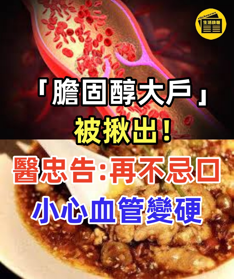 「膽固醇大戶」被揪出,是豬油的3倍,醫生忠告:再不忌口,小心血管變硬