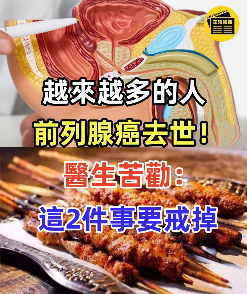 越來越多的人前列腺癌去世!醫生苦勸:這2件事,再愛也要戒掉