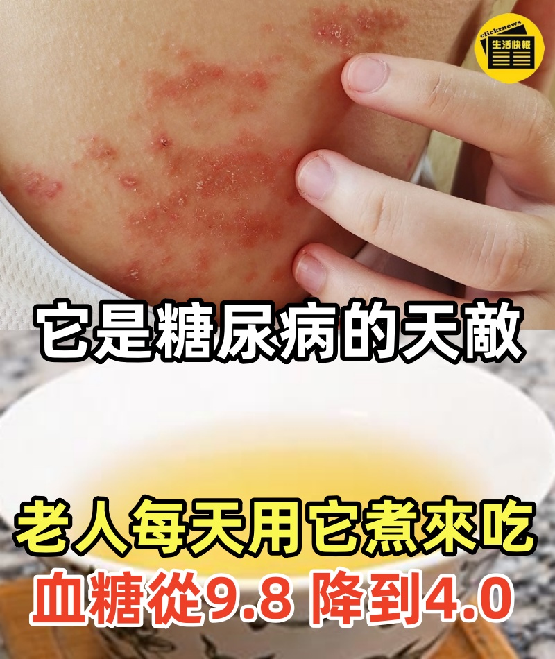 它是糖尿病的天敵,73歲老人每天用它煮來吃,血糖從9.8 降到4.0 結束30年的糖尿病!血脂降了,血壓也穩了!