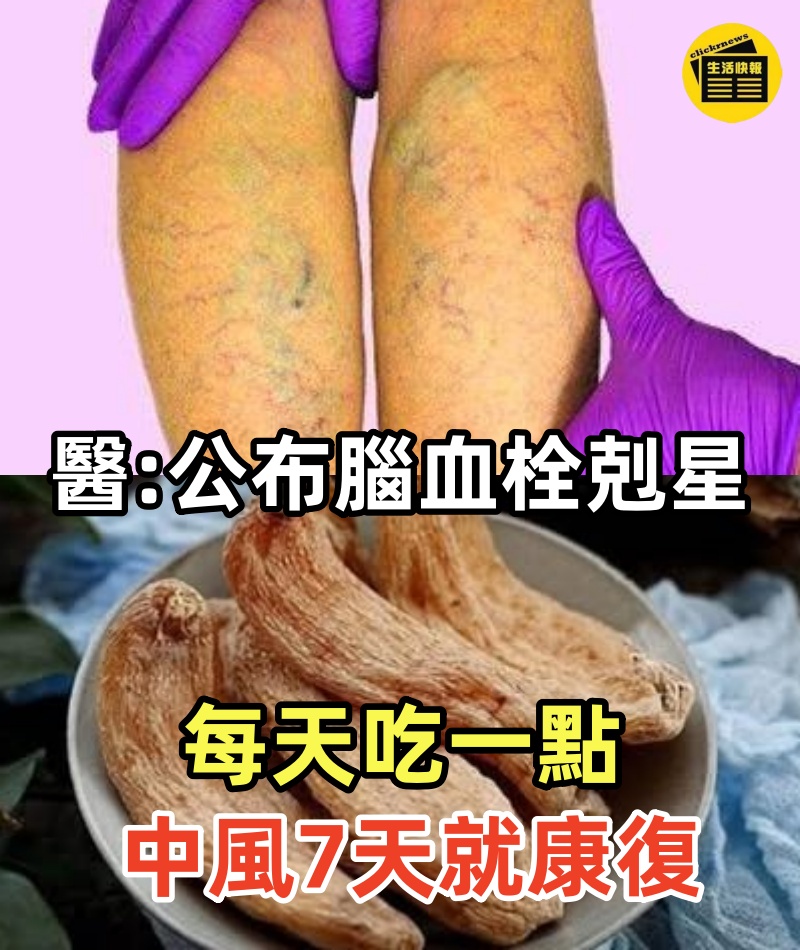 醫生公布腦血栓剋星,每天吃一點,80%腦部血栓悄悄消失了,大腦血管到90歲都不會堵塞,中風永遠找不上你!