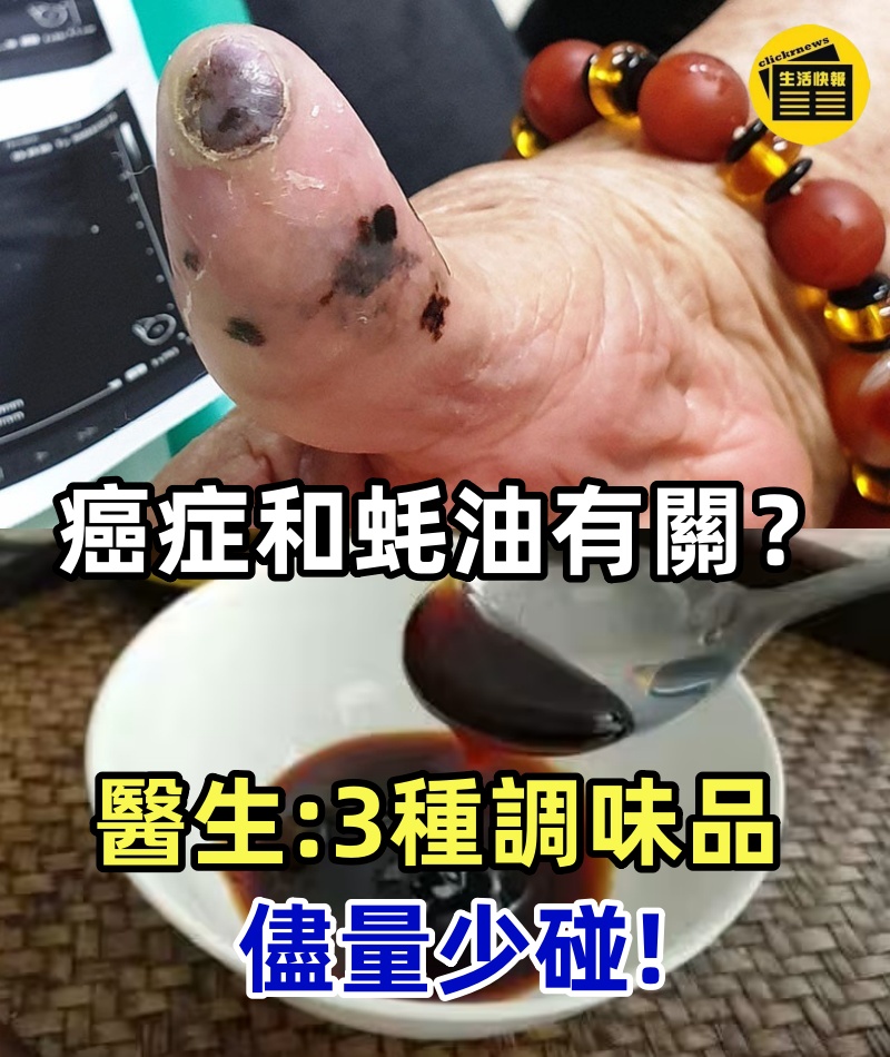 越來越多人得癌症,和蚝油有關?醫生警告:3種調味品,儘量少碰.