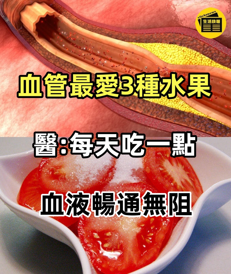 血管最愛這「3種水果」,醫生建議:每天吃一點,血液暢通無阻